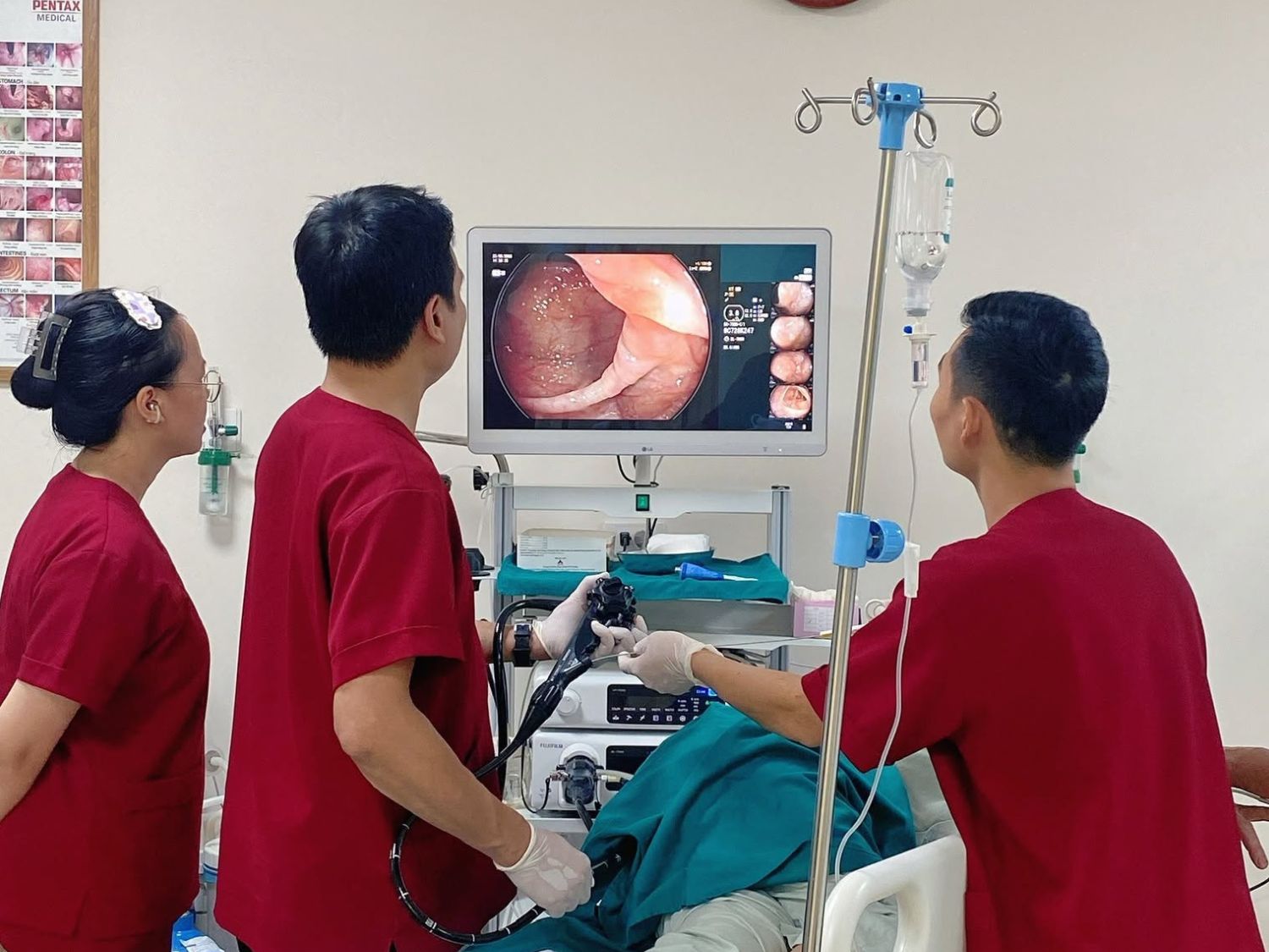 Có thể nội soi lại để kiểm tra còn polyp đại tràng hay không