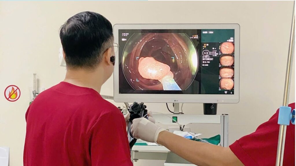 Tầm soát ung thư đại trực tràng ở đâu tốt tại Hà Nội?