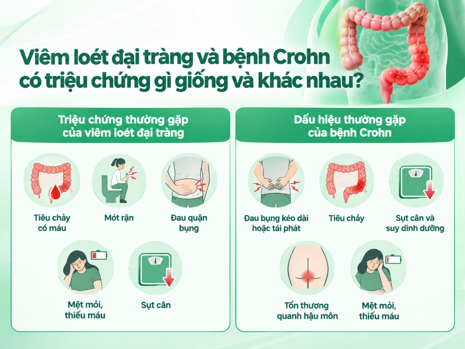 Viêm loét đại tràng và bệnh Crohn đều có thể gây đau bụng, tiêu chảy, mệt mỏi và sụt cân. Tuy nhiên, viêm loét đại tràng thường gặp tiêu chảy có máu và mót rặn, trong khi bệnh Crohn có thể gây tổn thương quanh hậu môn, đau bụng tái phát và suy dinh dưỡng.