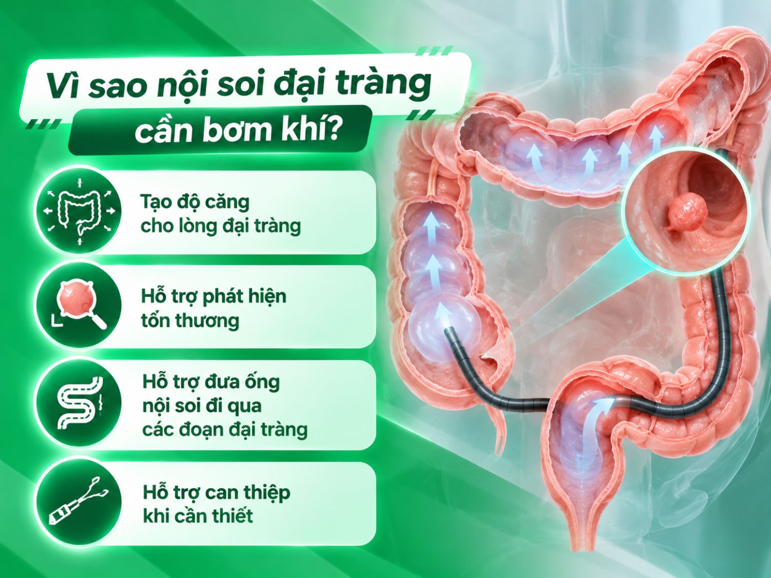 Bơm khí giúp làm căng lòng đại tràng, hỗ trợ bác sĩ quan sát niêm mạc, phát hiện tổn thương, đưa ống soi qua các đoạn ruột và thực hiện can thiệp khi cần thiết.