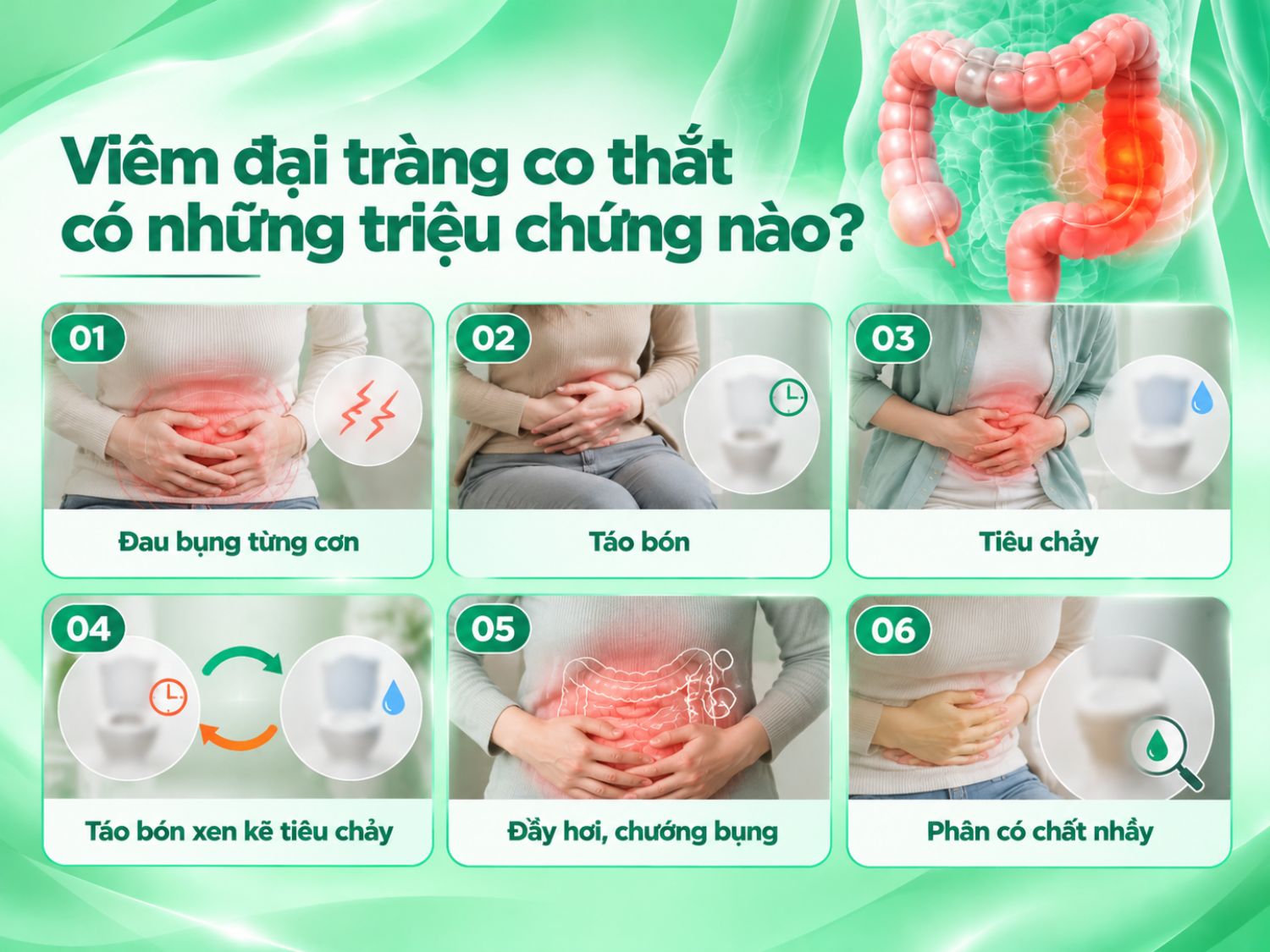 Viêm đại tràng co thắt (hội chứng ruột kích thích) thường gây đau bụng tái diễn, đầy hơi và thay đổi thói quen đại tiện. Người bệnh có thể bị táo bón, tiêu chảy hoặc xen kẽ cả hai, đôi khi xuất hiện chất nhầy trong phân. Các triệu chứng có thể thay đổi theo từng người.