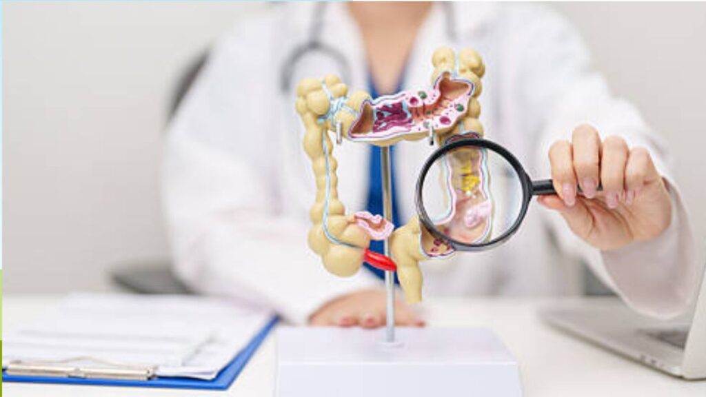 Xét nghiệm máu ẩn trong phân (FIT) có thay được nội soi không?