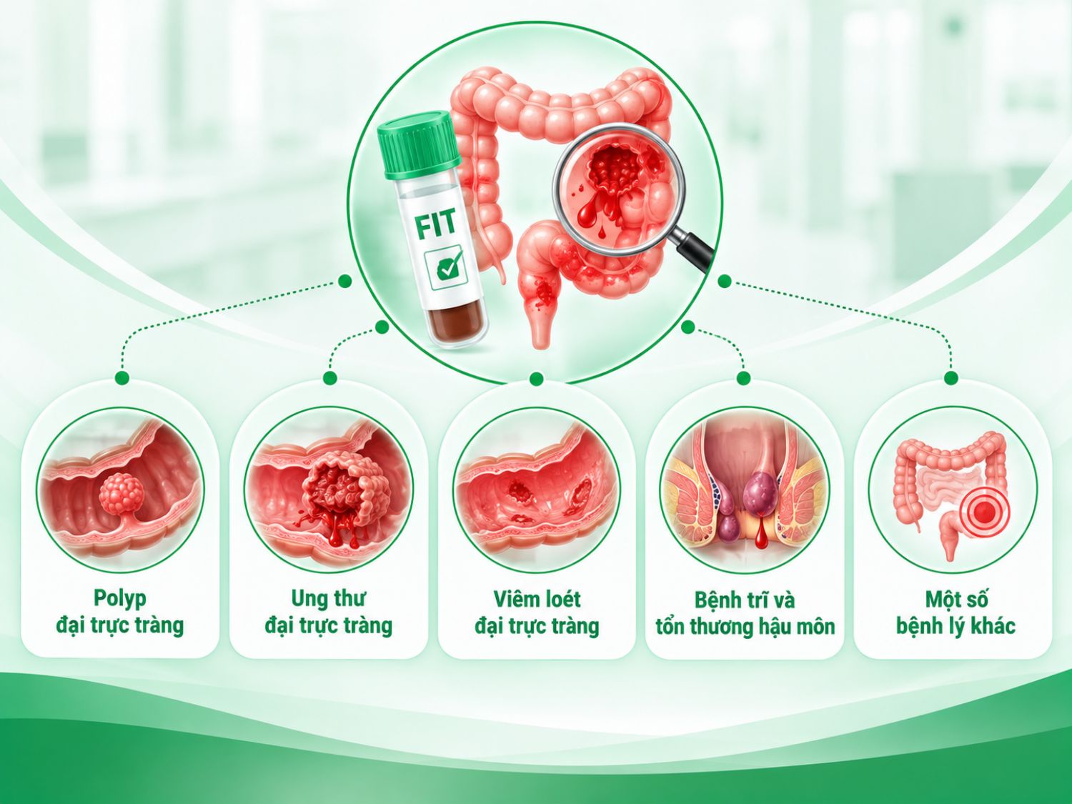 ảnh mô tả Xét nghiệm FIT có thể phát hiện dấu hiệu chảy máu liên quan