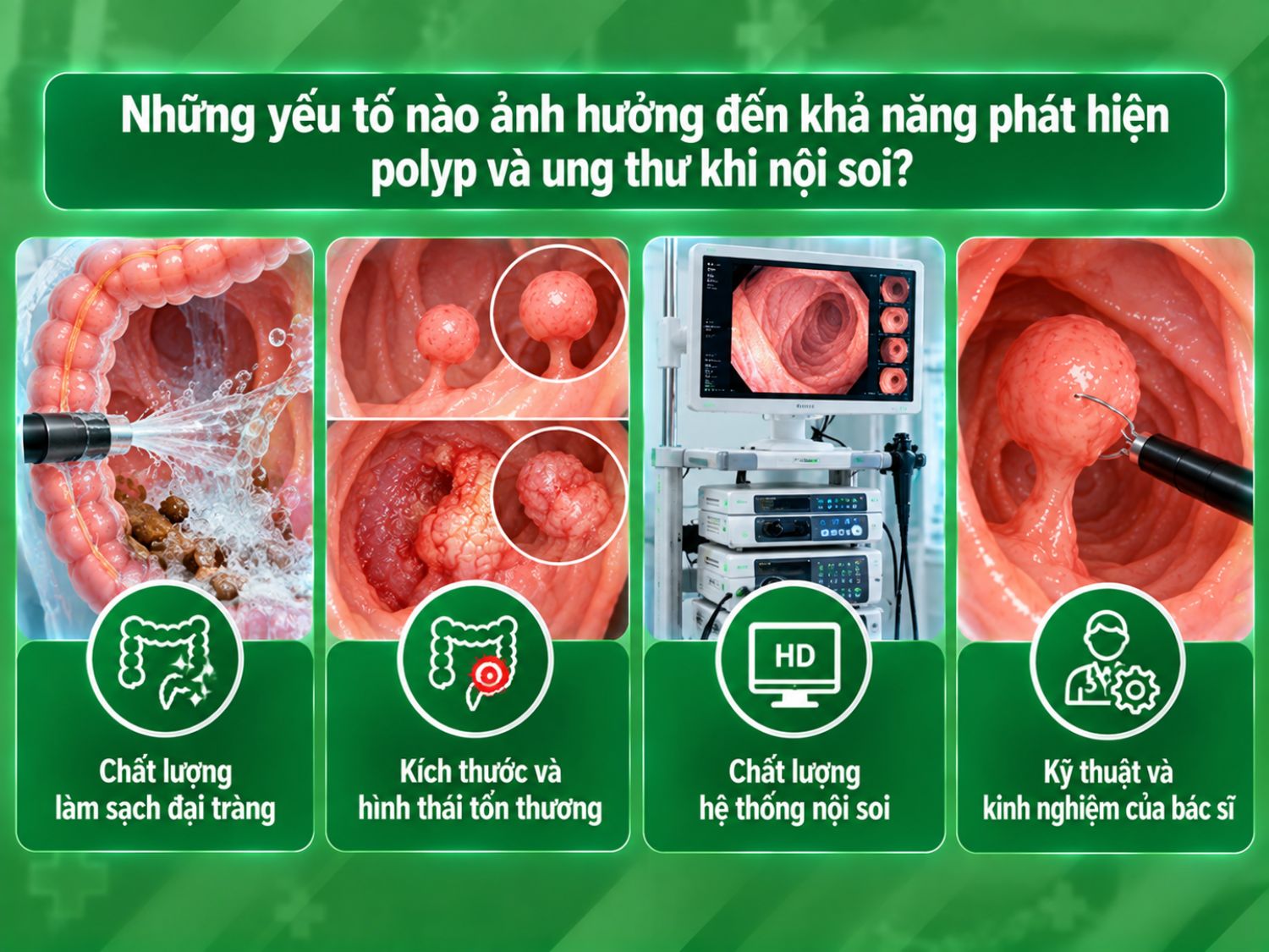 Khả năng phát hiện tổn thương phụ thuộc vào mức độ làm sạch đại tràng, kích thước và hình thái tổn thương, chất lượng hệ thống nội soi cũng như kỹ thuật và kinh nghiệm của bác sĩ.
