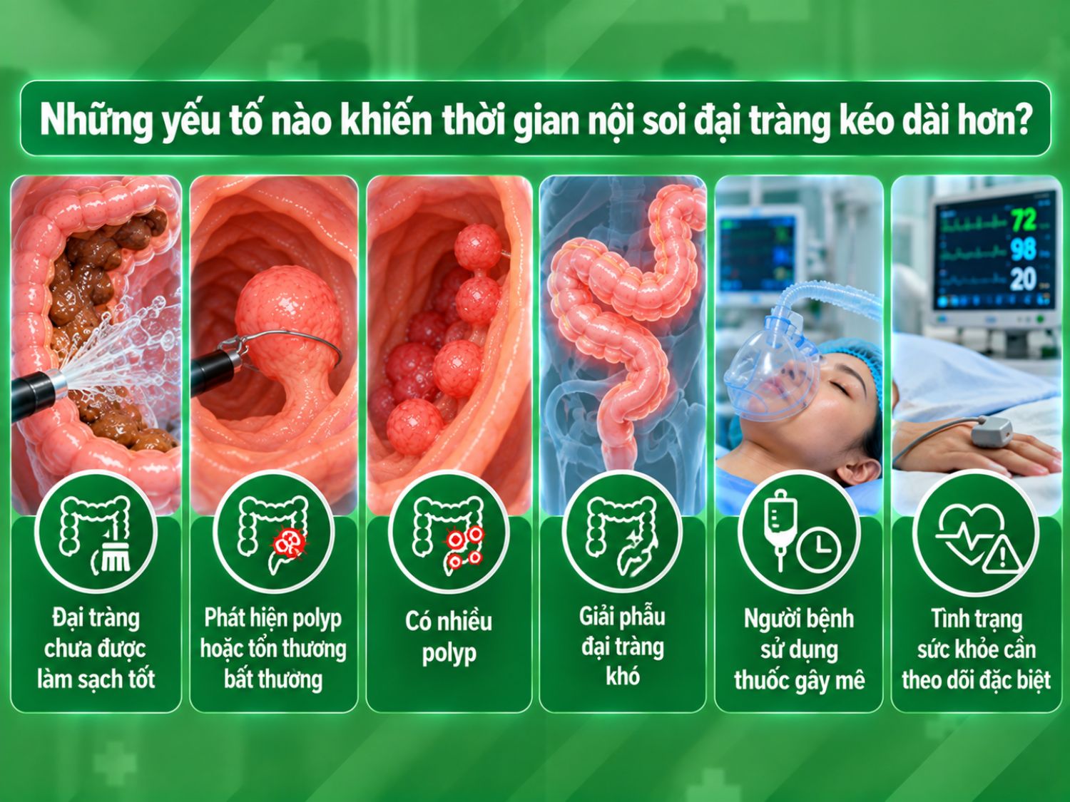Thời gian nội soi có thể kéo dài khi đại tràng chưa được làm sạch tốt, phát hiện polyp hoặc tổn thương, có nhiều polyp, giải phẫu đại tràng khó hoặc người bệnh cần gây mê và theo dõi đặc biệt.