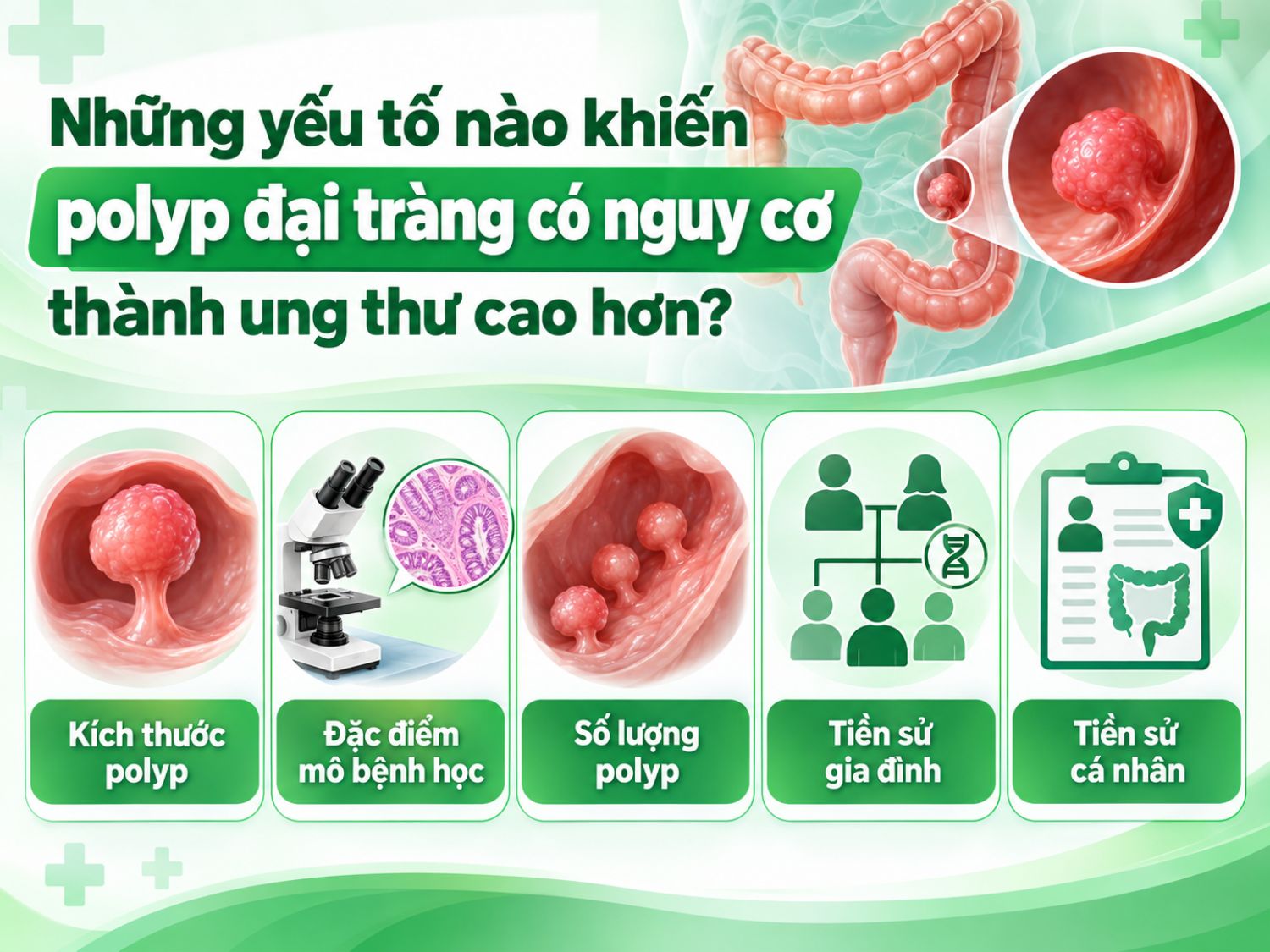 Nguy cơ polyp đại tràng tiến triển thành ung thư phụ thuộc vào kích thước, số lượng, đặc điểm mô bệnh học và tiền sử mắc polyp hoặc ung thư đại trực tràng của người bệnh và gia đình.